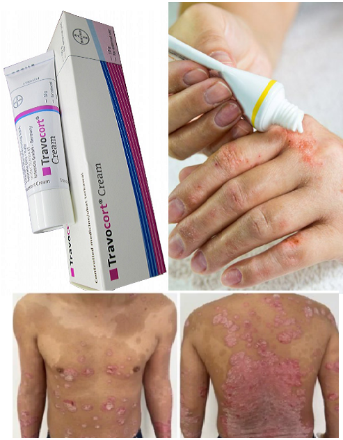 Dầu gội thảo dược